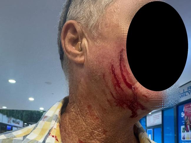 Shocking images have surfaced from Nerang where a young male allegedly attacked an elderly man at knifepoint. Picture: Facebook