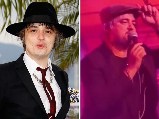 Rocker Pete Doherty in danger of amputation risk.