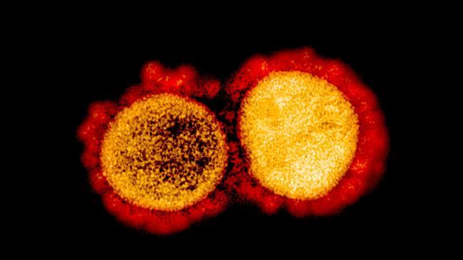 A transmission electron micrograph of SARS-CoV-2 virus particles, isolated from a patient. Picture: AFP