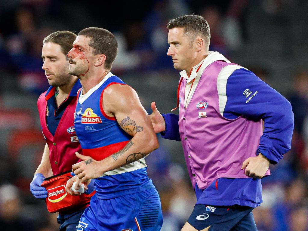 Liberator leaves the field after copping a stray boot to the face. Picture: Dylan Burns/AFL Photos