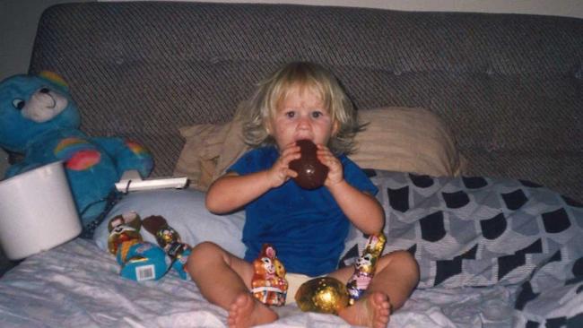 Despite having chickenpox, Keyra Steinhardt was still allowed to have her Easter chocolate.