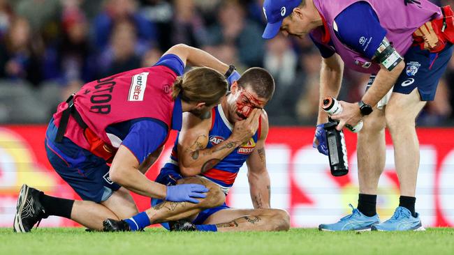 Tom Liberatore is treated after his face was cut and he was concussed. (Photo by Dylan Burns/AFL Photos via Getty Images)