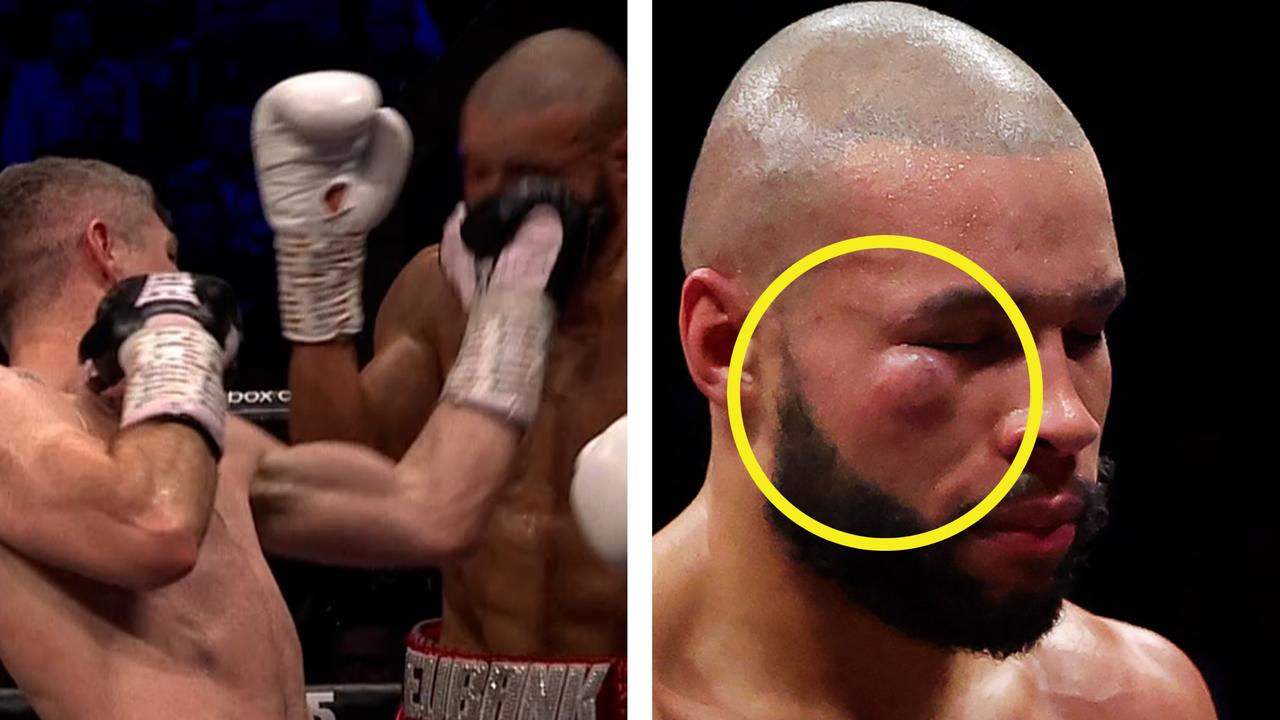 Liam Smith left a brutal mark on Chris Eubank Jr's face. Picture: Supplied