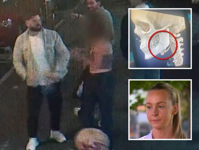 A young woman had her jaw fractured in a violent street attack, senior constable Elissa Dykstra (pictured bottom left) said.