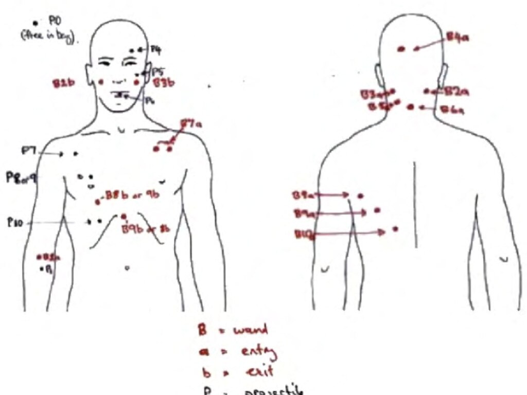 Court documents showed the bullet wounds on Pasquale Barbaro's corpse. Picture: Supplied.