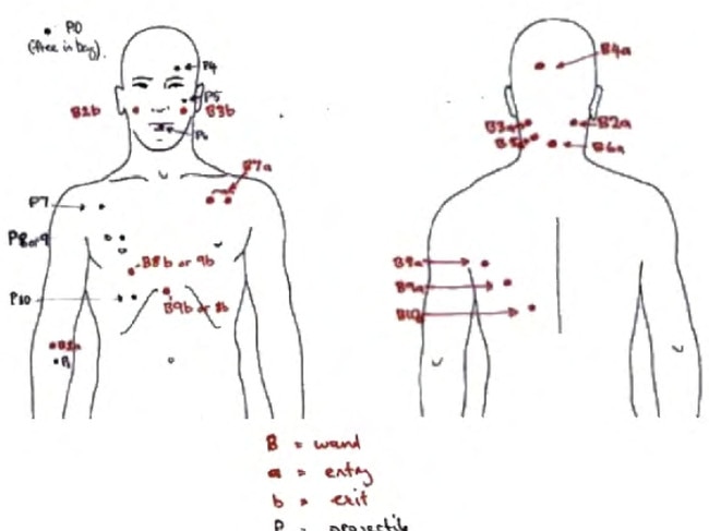 Court documents showed the bullet wounds on Pasquale Barbaro's corpse. Picture: Supplied.