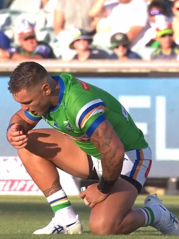 The blood was pouring from his mouth. Photo: Fox Sports