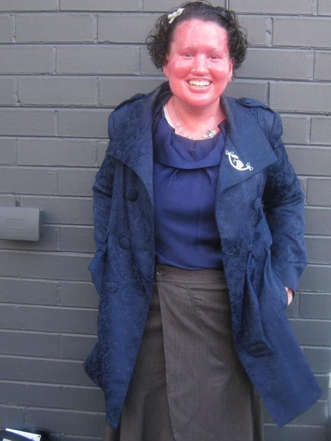 Disability advocate and appearance activist Carly Findlay.