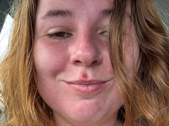 Reason behind woman's red-faced selfie revealed. Picture: Supplied