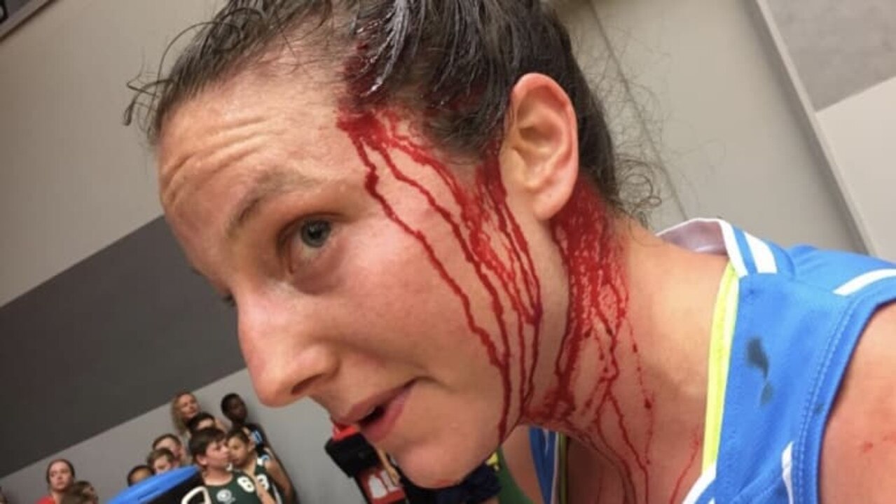 Kelsey Griffin was busted open against Perth Lynx. Picture: The Canberra Times (Fairfax)