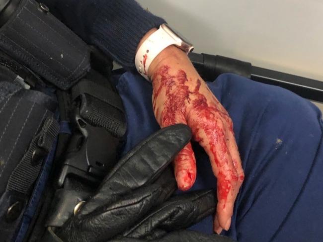 The female officer was left covered in blood after the incident. Picture: NSW Police