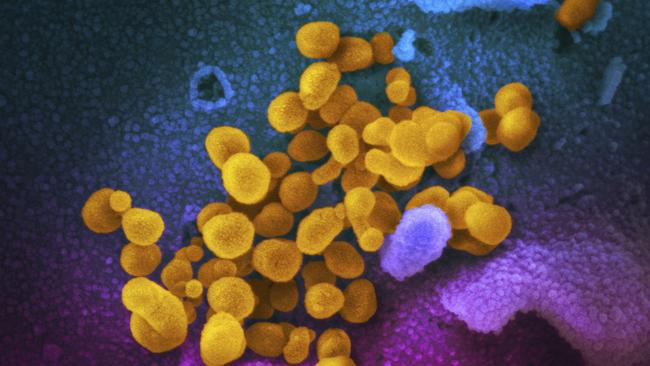 The Novel Coronavirus SARS-CoV-2, yellow, emerging from the surface of cells, blue/pink, cultured in the lab. Also known as 2019-nCoV, the virus causes COVID-19.