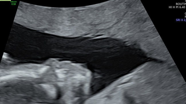 Imogen shares a new instalment of her pregnancy diary every week, this is part one of the birth.