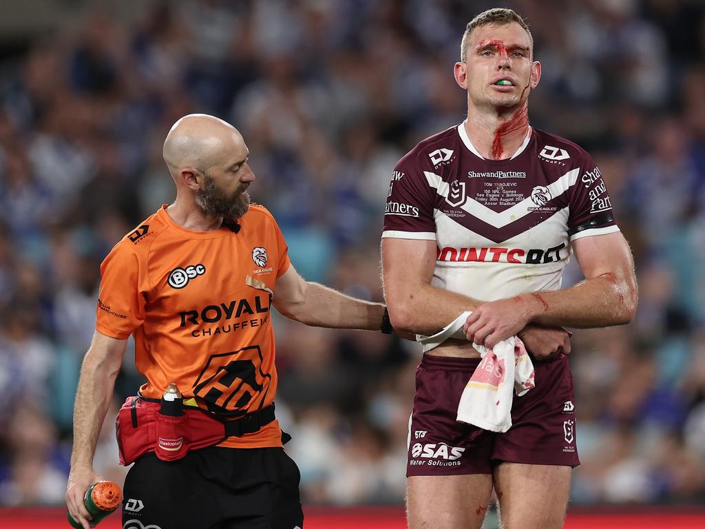 There have been calls for Tom Trbojevic to switch positions to protect himself from injuries. Picture: Cameron Spencer/Getty Images