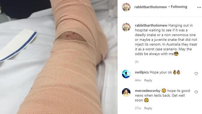 Surfing legend Wayne "Rabbit" Bartholomew hospitalised after snake bite. Picture: Instagram.