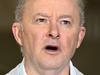 Albo faces backlash over diversity comment