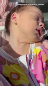 RSV can cause bronchiolitis and pneumonia in infants and young children