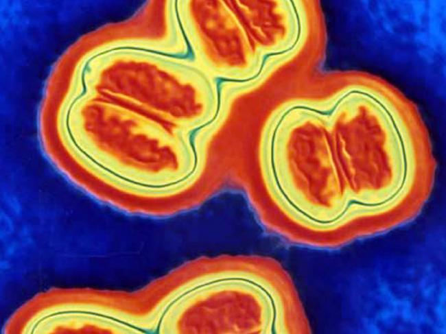 18/03/2004 PIRATE: Meningococcal (neisseria meningitidis) disease bacterium germs under a microscope. meningitis bacteria (Courtesy of Photo Researchers Science Photo Library)