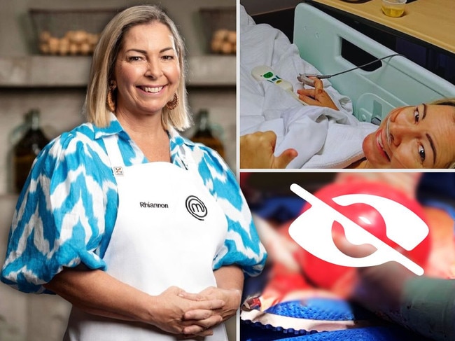 rhiannon anderson masterchef cancer scare2