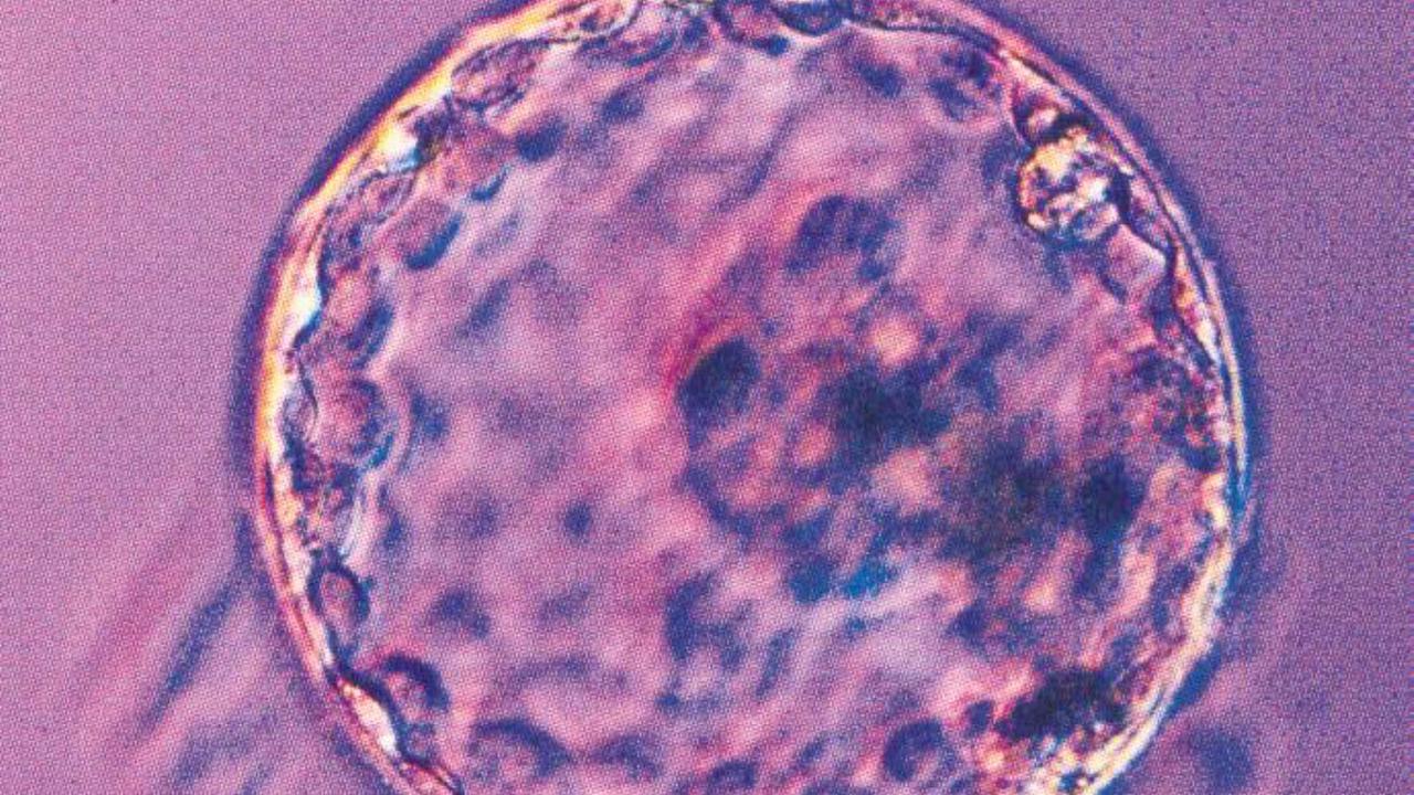 Embryos infected in hospital clinic