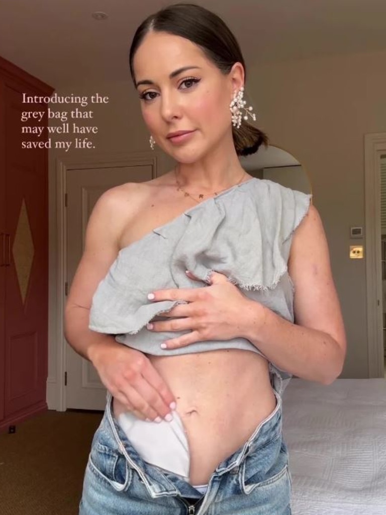 She described the stoma bag as 'life-saving'. Picture: Instagram/Louise Thompson