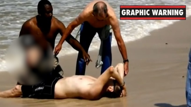 Horror moment man loses leg in shark attack