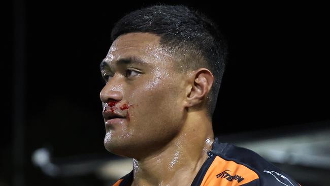 SYDNEY, AUSTRALIA - JULY 06: Stefano Utoikamanu of the Wests Tigers leaves the fiels with a bloody nose and ripped shirt during the round 18 NRL match between Wests Tigers and Melbourne Storm at Leichhardt Oval, on July 06, 2024, in Sydney, Australia. (Photo by Scott Gardiner/Getty Images)