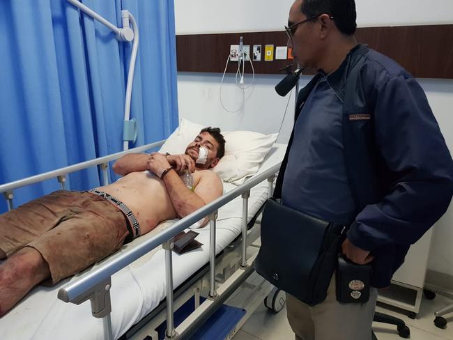 South Australian Nicholas Carr in hospital recovering from injuries suffered during a bizarre rampage on a busy street in Bali. Picture: Lukman S. Bintoro