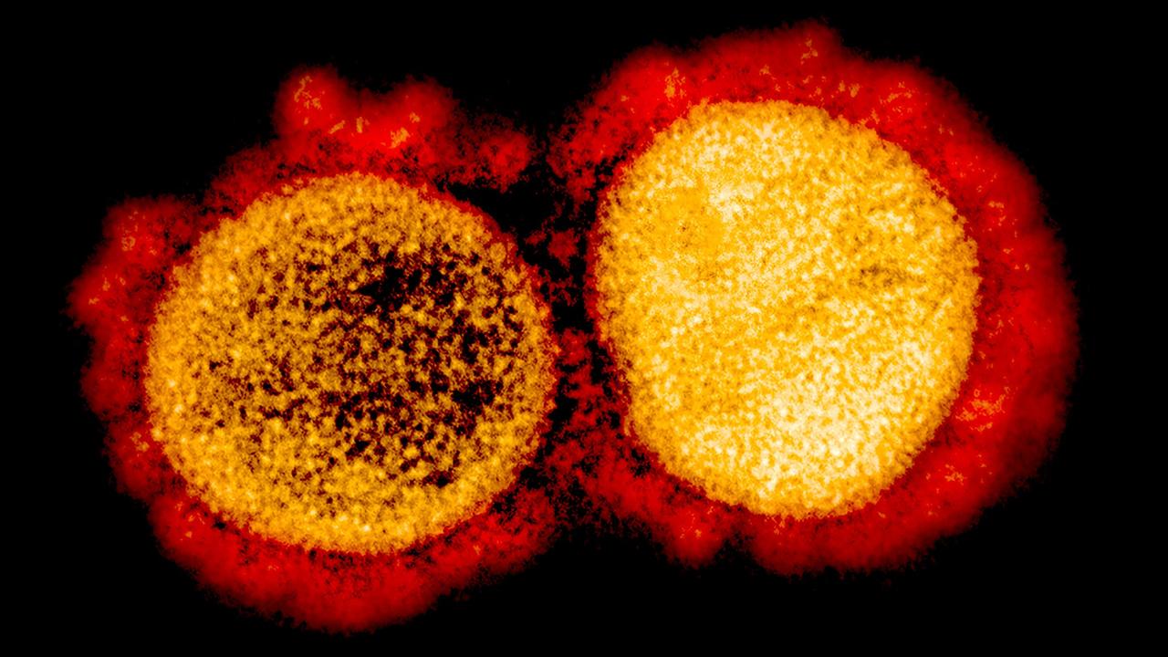 The test is the first on the market to identify whether the virus is replicating and the viral load. Picture: National Institute of Allergy and Infectious Diseases/AFP