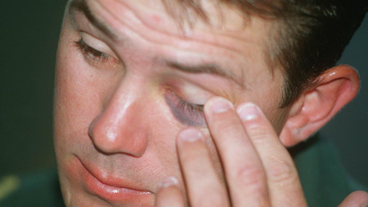/hobart tas sport not cricket 20 jan 1999 Ricky Ponting suspended from the Australian team after being involved in a fight at the Bourbon & Beef Bar @ /Kings /Cross in /Sydney on 18/1/99 pic:fred/kohl headshot black-eye & red ear injuries sad