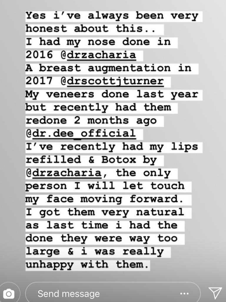 She expressed regret over the fact her lip filler wasn’t very natural looking. Picture: Instagram / Keira Maguire