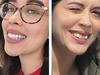 Teeth-straightening giant accused of deceiving Aussies