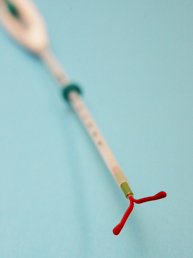 A Mirena IUD. Picture: Jeff Camden