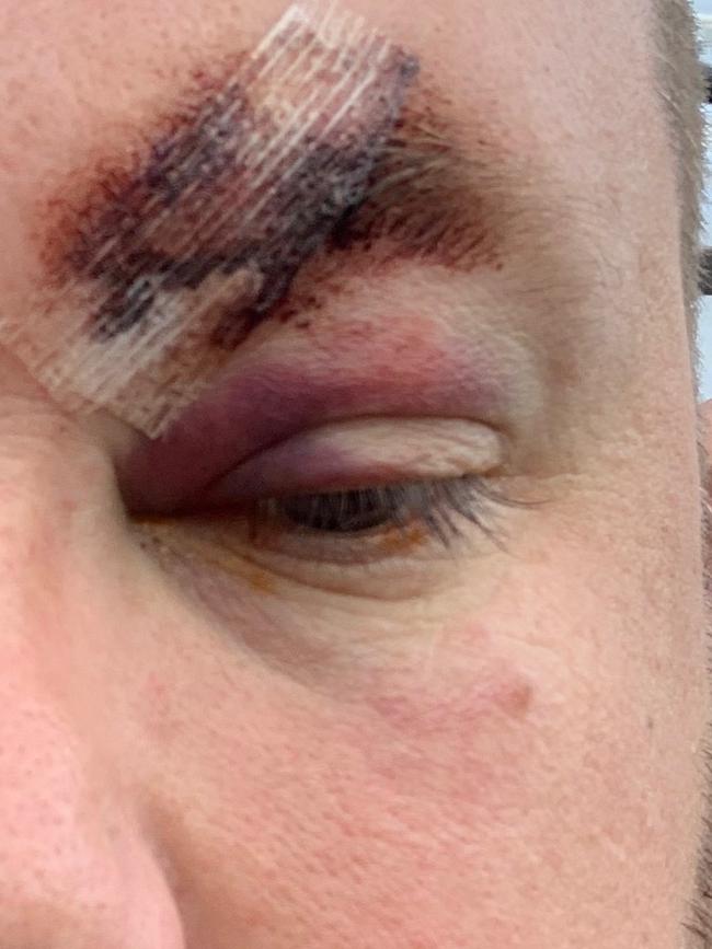 One of three police officers assaulted in Maitland following a vehicle stop. Credit: NSW Police