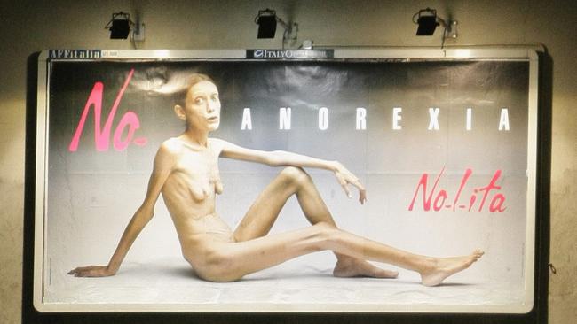 Isabelle Caro became a poster girl for anorexia nervosa. This Italian ad campaign ran in Milan in 2007. Photo: Venturelli/WireImage.