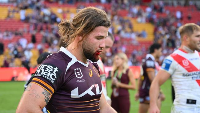 Pat Carrigan will see a plastic surgeon to repair his busted lip.