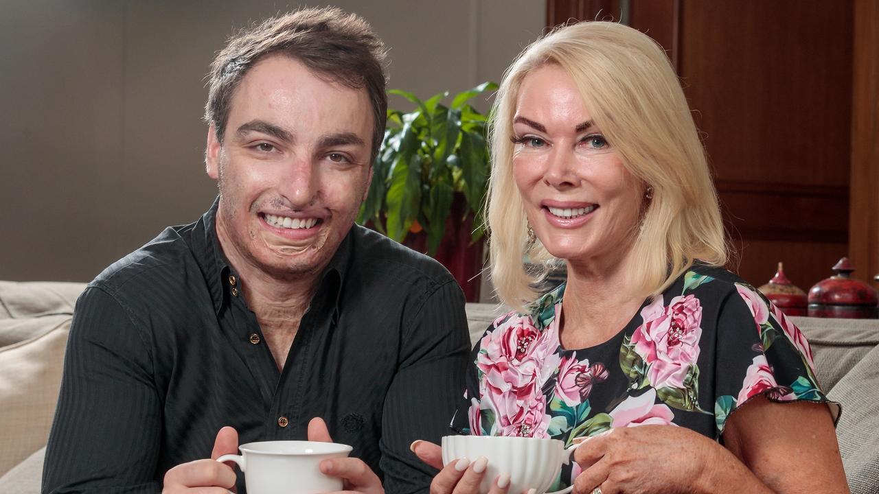 Janet Roach and son Jake have stared Raw Essential Tea, now selling in Coles, Richies and Chemist Warehouse.