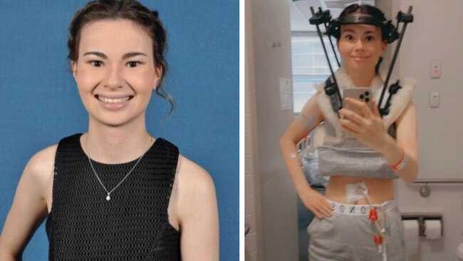 Lily Thai in June 2017, around the time of her first diagnosis, and then at 23 in the final year of her life, receiving medical treatment in hospital. Picture: Supplied.