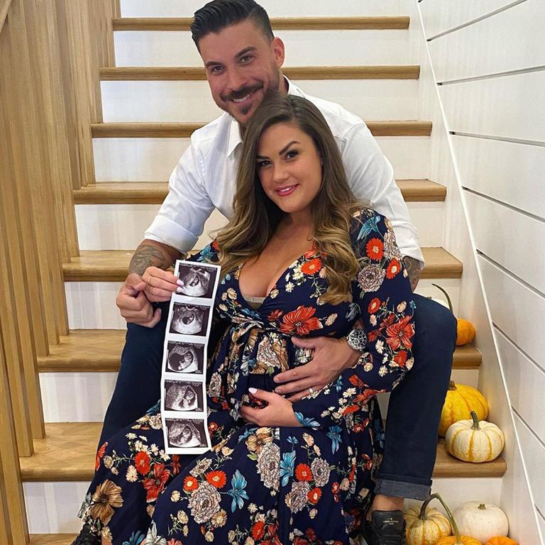 Jax Taylor and Brittany Cartwright are expecting their first child together