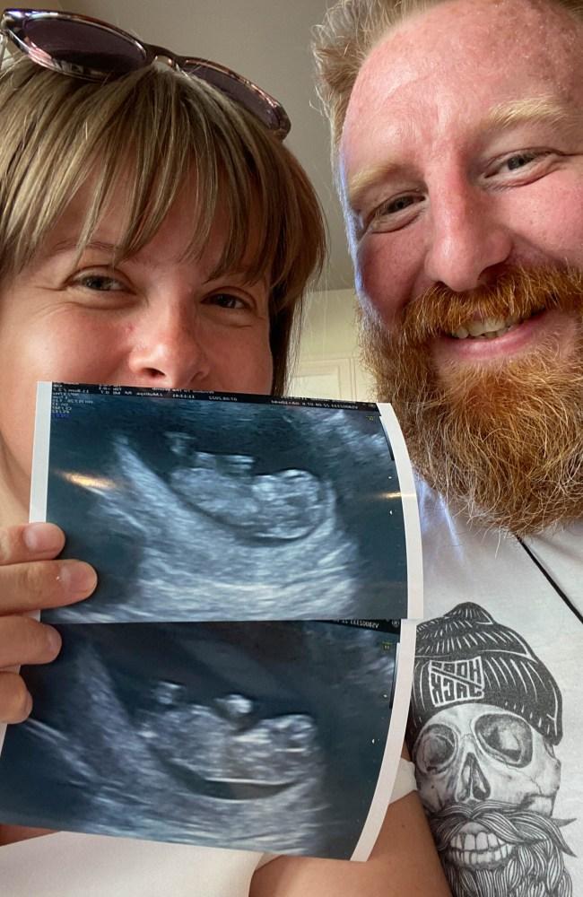 Jennifer and Matthew hold an ultrasound from their pregnancy with Teddy. Picture: Caters News 