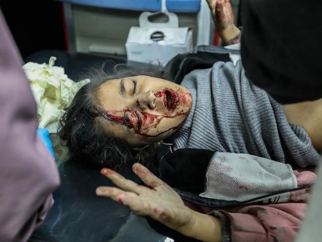 A young Palestinian injured in Israeli air strikes arrives for treatment at Kuwait Hospital. Picture: Getty Images