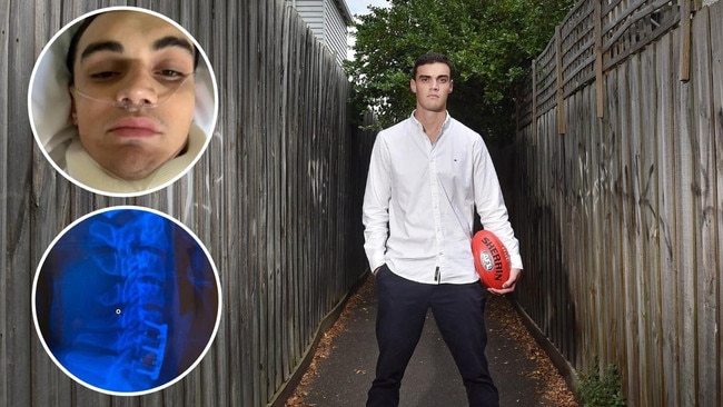 Patrick Bines’ life changed forever after an incident on the football field.