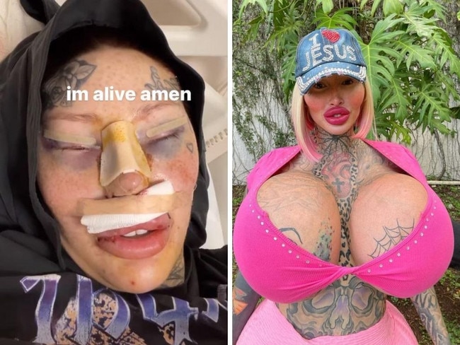 Plastic surgery addict shows off new look