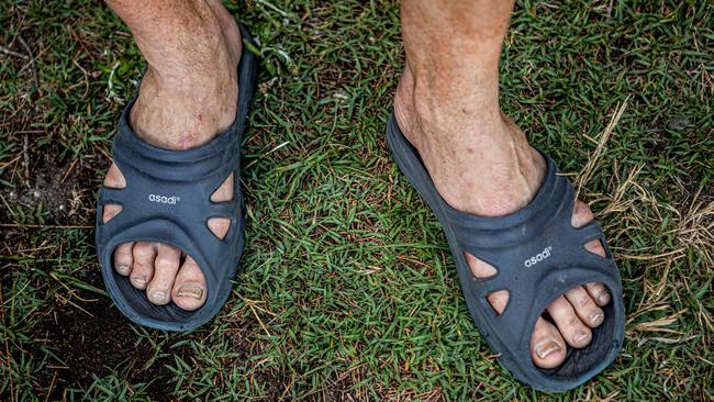 Philip Balnave's feet before the race. Picture: Marilia Ogayar