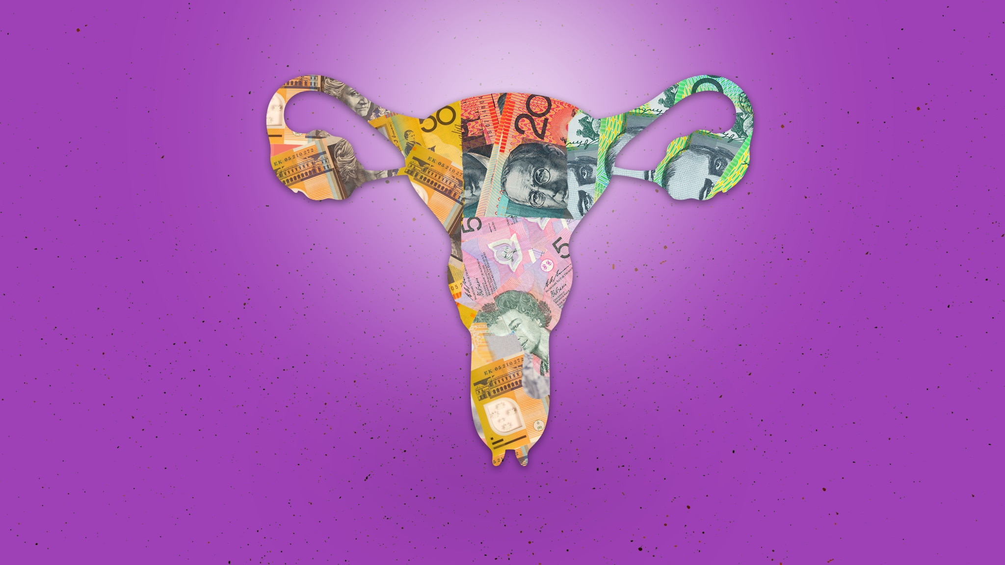 misoprostol cost australia