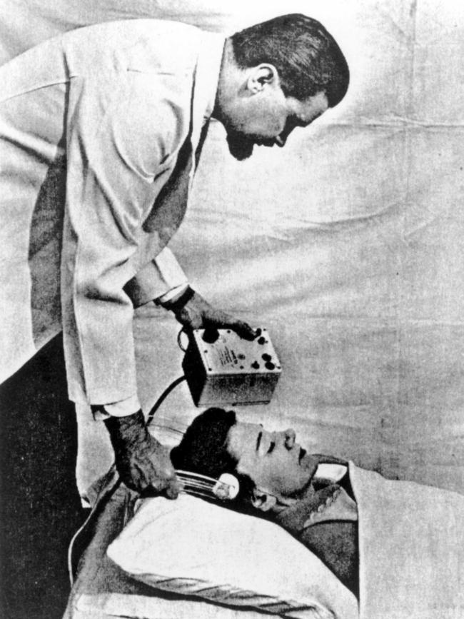 Dr Harry Bailey, former chief psychiatrist at Chelmsford Nursing Home in Sydney in undated copy photo demonstrating the use of shock treatment on patient.