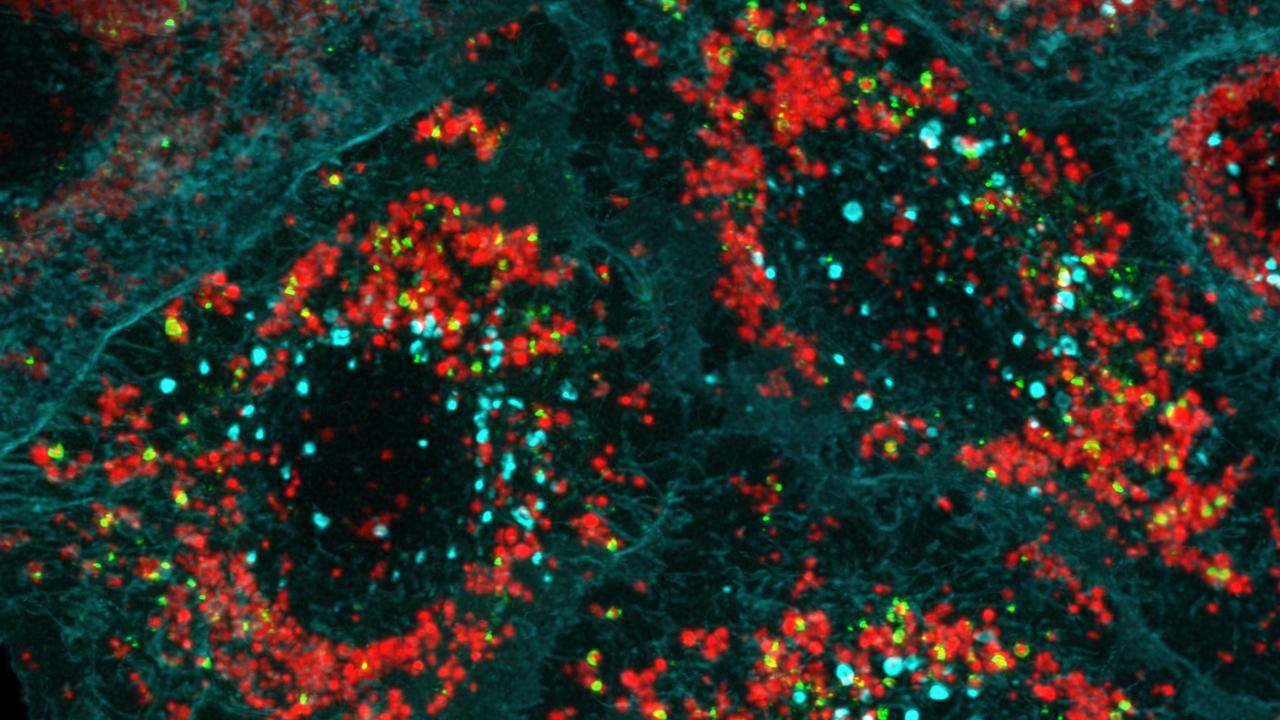 Garbage bags being built through Optineurin (green), around damaged mitochondria (red). Picture: WEHI