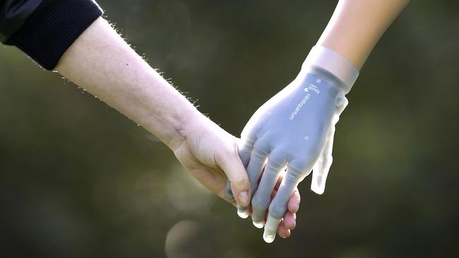 Alan Newey, holding hands with wife Kathy Dimitrio in the park, with his new mind-controlled robotic arm. Picture: David Caird