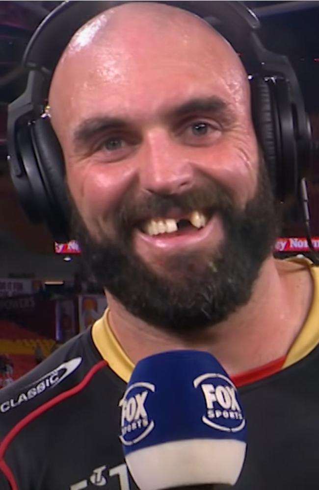 Dolphins prop Mark Nicholls flashes his ‘toothy’ grin on live television. Credit: Fox Sports.