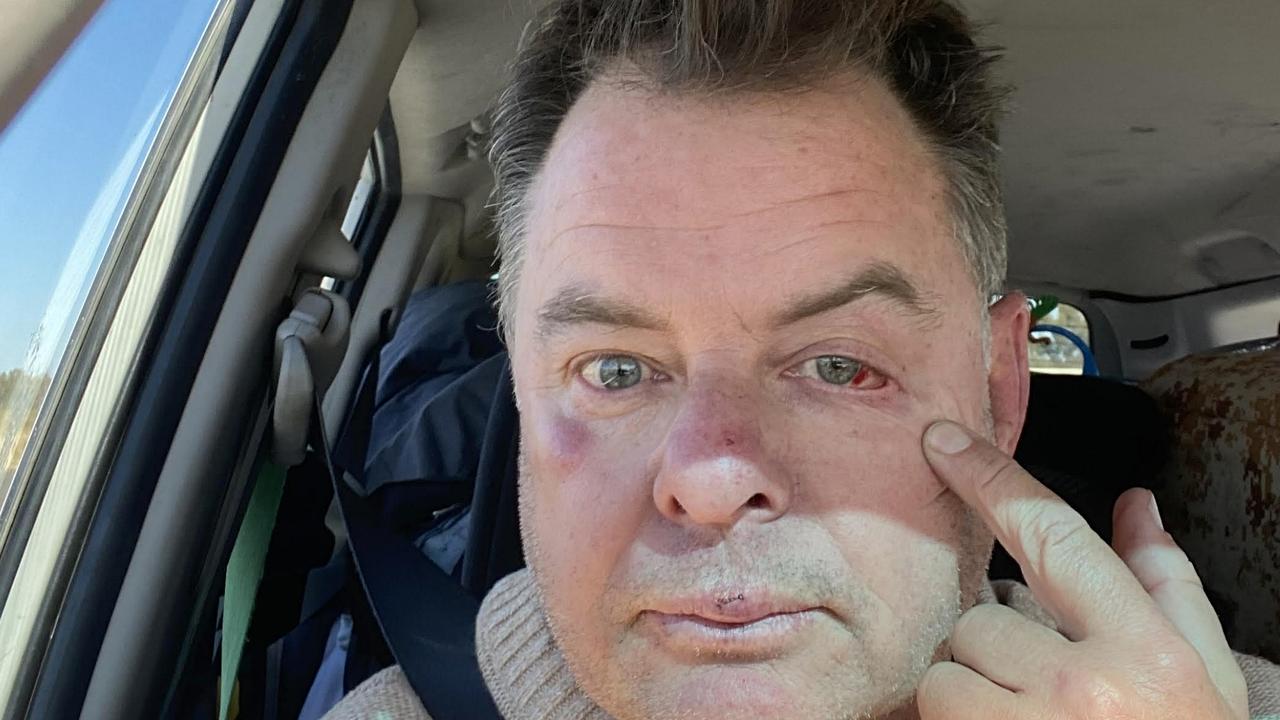 Surfing identity dragged from car, bashed in rest stop horror